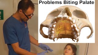 Problems Associated with Biting on Palate Roof of Your Mouth Maxilla by Dr Mike Mew [upl. by Ettevy]