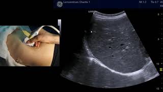 Sonographie der Leber systematische Durchmusterung [upl. by Ylrahc]