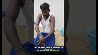 elbow dislocation treatment  முழங்கை மூட்டு விலகல்  vadapalani  puttur kattu [upl. by Kirch]