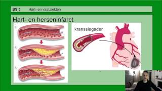 Basisstof 5 Hart en vaatziekten [upl. by Pietrek]