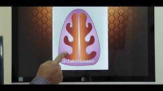 Nasal turbinate hypertrophy Part 1 Malayalam Patient teaching [upl. by Aramoy]