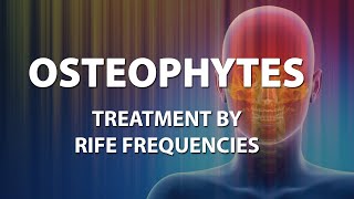 Osteophytes Bone Spurs  RIFE Frequencies Treatment  Energy amp Quantum Medicine with Bioresonance [upl. by Harvie]