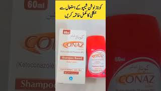 Conaz Shampoo for Dandruff and Hair Fall  AK Beauty Reviews [upl. by Penni]