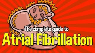 Complete Guide To Atrial Fibrillation Causes symptoms and treatments [upl. by Engel972]