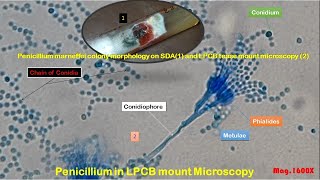 Penicillium marneffei colony morphology on SDA and LPCB tease mount Microscopy [upl. by Aural766]