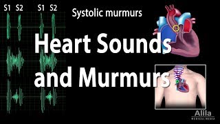 Heart Sounds and Heart Murmurs Animation [upl. by Enogitna]