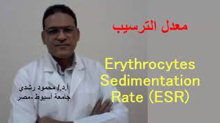 Erythrocytes Sedimentation rate ESR  معدل ترسيب خلايا الدم الحمراء [upl. by Anihtyc]