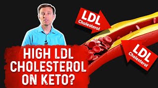 Why High LDL Cholesterol on the Ketogenic Diet – Dr Berg [upl. by Buseck]