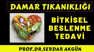 Damar Tıkanıklığı Bitkisel Tedavi ile Açılır mı Bitkiler Damar Tıkanıklığı Tedavisi [upl. by Carnahan]