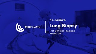 Micromate™  CTguided RoboticAssisted Lung Biopsy Prof Dimitrios Filippiadis [upl. by Anelah]