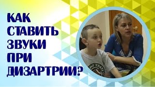 Постановка звуков при дизартрии Как поставить звук Ц при дизартрии [upl. by Enoid]