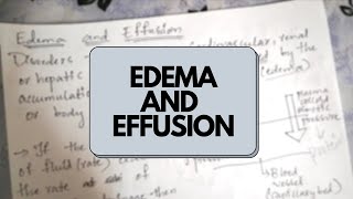 Edema and Effusion  Haemodynamic Pathology [upl. by Malchus]