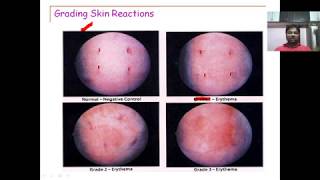 Skin Irritation Tests for semisolids [upl. by Ostler]