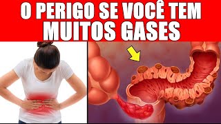 Alerta Por Esta Razão Perigosa você tem MUITOS GASES e ninguém te conta [upl. by Christen]