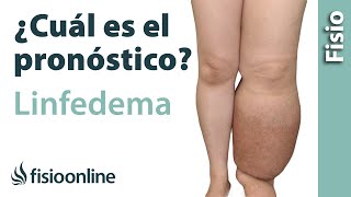 🦵🏻¿Cuál es el PRONÓSTICO del LINFEDEMA🤔 [upl. by Derian]