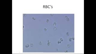 Microscopic Urinalysis [upl. by Lairea]