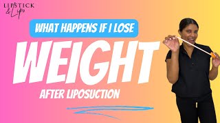 What happens to my liposuction results if I lose weight [upl. by Fidole]