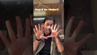 Nose Strips  Blackheads kaise hatae  Sanfe Nose Strip review 🤍 blackheads whiteheads [upl. by Asilrak]