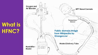 What is HFNC [upl. by Nivart]