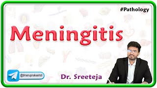 4 Meningitis  USMLE Step 1 Pathology [upl. by Obed]