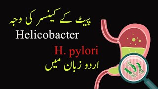 Understanding H Pylori The Stomach CancerCausing Bacteria  Symptoms Treatment amp Prevention [upl. by Orlena]