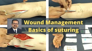 Wound Management  Basics of suturing  How to hold surgical instruments [upl. by Lesko]