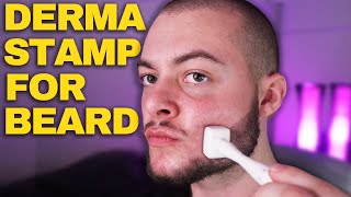 How To Derma Stamp Beard Properly Derma Stamp Tutorial Minoxidil amp Derma Stamp [upl. by Drawdesemaj357]