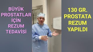 Rezum Prostat Tedavisi 130 GRAM Prostat için Gerçekleştirildi Lokal Anestezi ile Rezum Yapılır mı [upl. by Embry833]