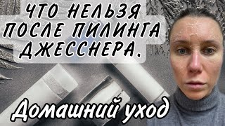 КАК ВЕСТИ СЕБЯ ПОСЛЕ ПИЛИНГА ДЖЕССНЕРАЧТО МОЖНОЧТО НЕЛЬЗЯХИМИЧЕСКИЙ ПИЛИНГ [upl. by Anirbys]