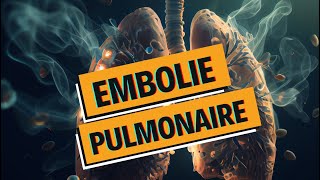 EMBOLIE PULMONAIRE et PHLEBITE  tout comprendre  WhyDoc 1 [upl. by Nisbet]