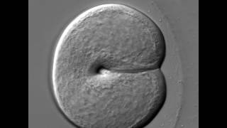 The first cell division of a ctenophore embryo [upl. by Assille718]