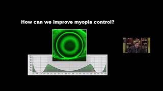 Improving the Myopia Controlling Effect in OrthoK Treatment [upl. by Nilyahs]