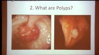 Colorectal Cancer Screening amp Treatment Part 1 of 7 [upl. by Eelam]