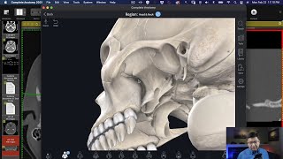 The Ins and Outs of the Pterygopalatince Fossa [upl. by Aniala]