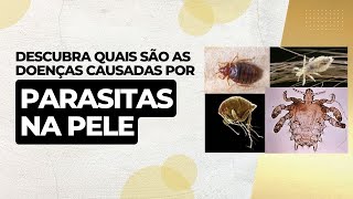 Descubra quais são as doenças causadas por parasitas na pele [upl. by Jonathan]