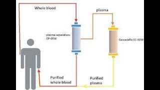 DFPP double filtration Plasmapheresis [upl. by Ativel957]