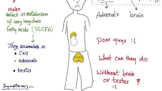 Adrenoleukodystrophy ALD mnemonic [upl. by Arst]