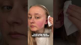 What to Do If You Have an Ear Bump  Piercing Healing Tips  EricaJewels  Ear Infection  Tips 101 [upl. by Haeli384]