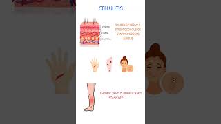 CELLULITIS PATHOPHYSIOLOGY [upl. by Bein]