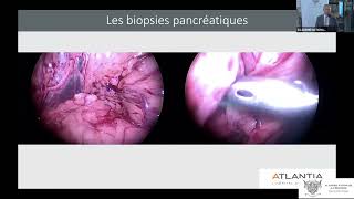 04 Utilisation de la coelioscopie en chirurgie digestive et obstétricale des animaux de compagnie [upl. by Deaner]