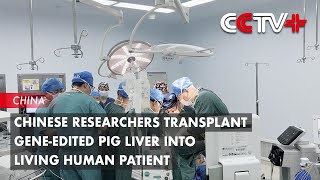 Chinese Researchers Transplant Geneedited Pig Liver into Living Human Patient [upl. by Gambrell]