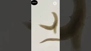 planaria flatworm Easy Mind Hindi short [upl. by Anitsenre]