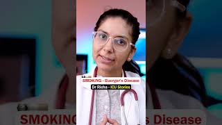 Smoking amp Buergers Disease  ICU Stories  Dr Richa Tiwari [upl. by Yennor]