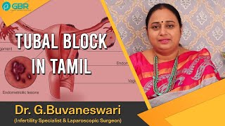 Hydrosalpinx Treatment amp Causes Tubal block in Tamil  Dr G Buvaneswari  GBR Clinic Nellore [upl. by Okime]