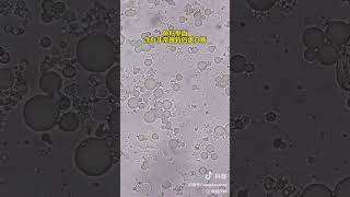 Do you like to eat fish roe Fish roe World science under the microscope [upl. by Tillman]