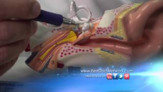 Middle Ear Reconstruction with Dallas Otologist Dr Yoav Hahn [upl. by Akemrej]