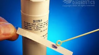 Microbiology oxidase test [upl. by Nirehs]