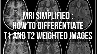 T1 vs T2 weighted images in MRI [upl. by Siduhey]