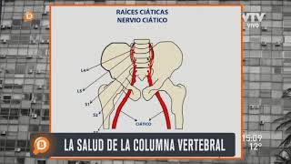 ¿Qué es la ciática o ciatalgia  Dr Isaac Jakter [upl. by Avehs]