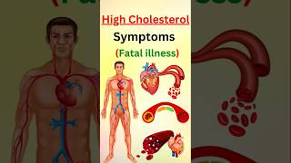 STOP Ignoring These Warning Signs of High Cholesterol [upl. by Gisela323]